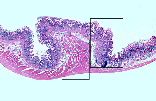  pyloro/duodenal junction 