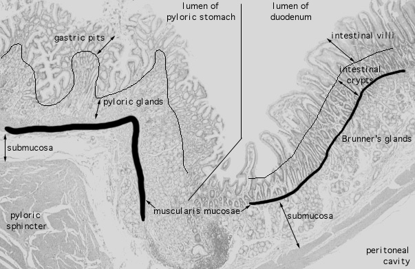  pyloro/duodenal junction, mucosa 