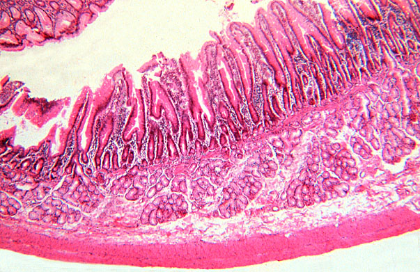  pyloro/duodenal junction, duodenum 