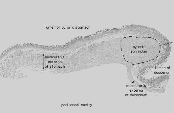  pyloro/duodenal junction II 