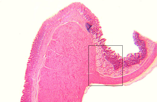  pyloro/duodenal junction 