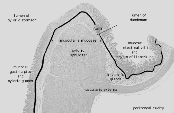  pyloro/duodenal junction 