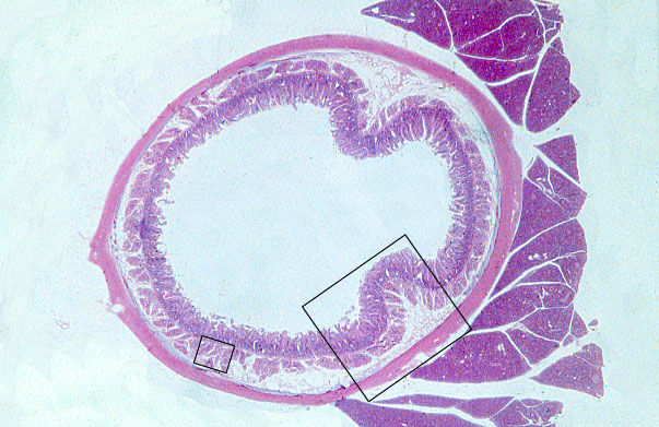  duodenum 