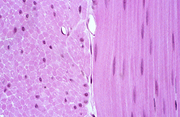  smooth muscle, muscularis externa 