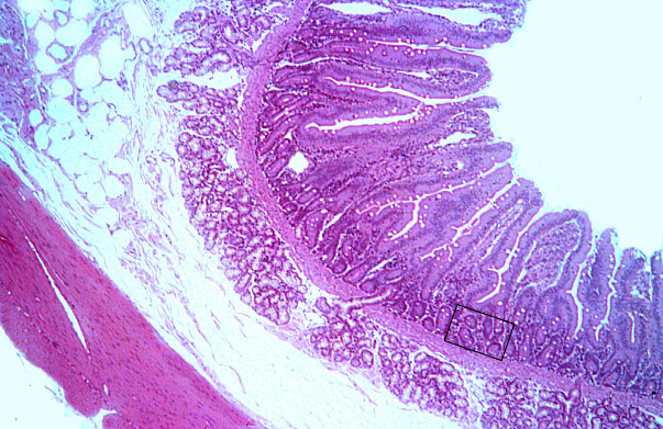  duodenum, enteroendocrine cells 