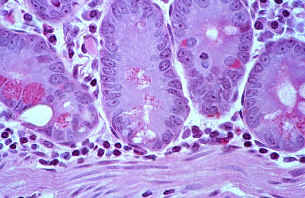  duodenum, enteroendocrine cells 