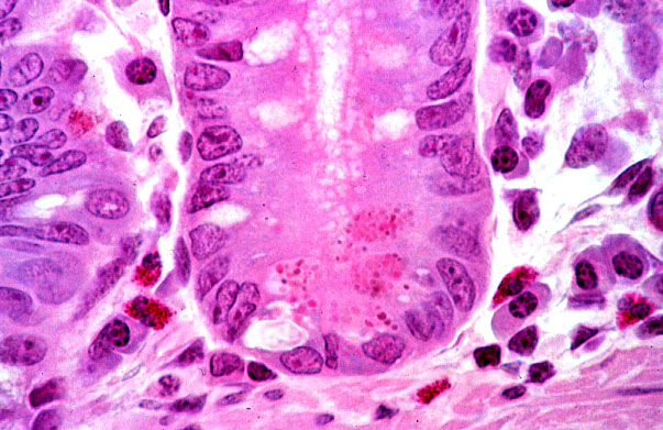  duodenum, paneth cells 
