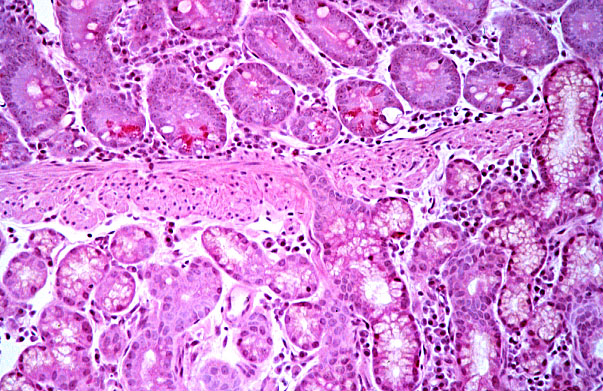  duodenum, Brunner's glands 