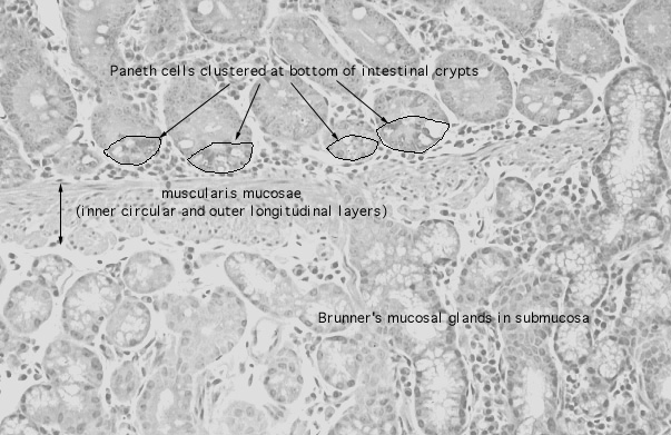  duodenum, Brunner's glands 