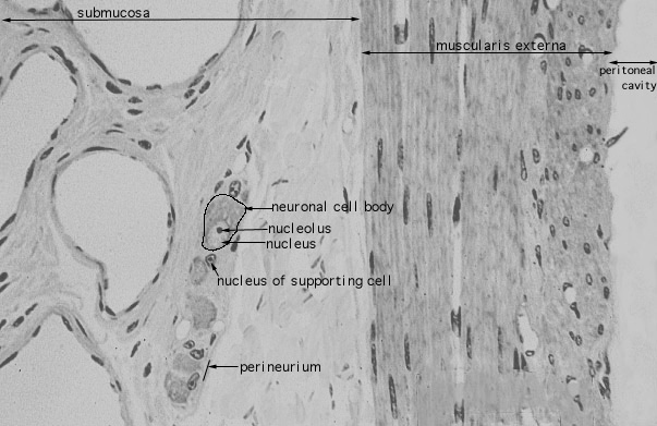 jejunum, central lacteals 