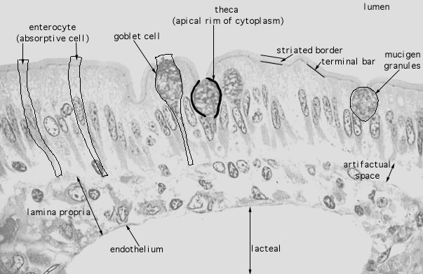  jejunum, goblet cells and enterocytes 