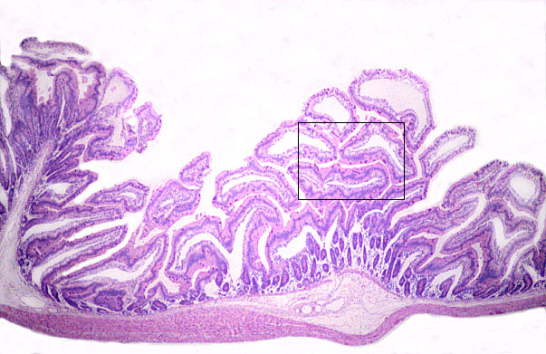  jejunum 