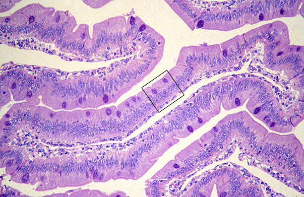 jejunum, central lacteals 