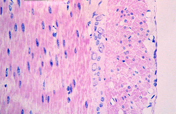  parasympathetic plexuses, myenteric plexuses of Auerbach 