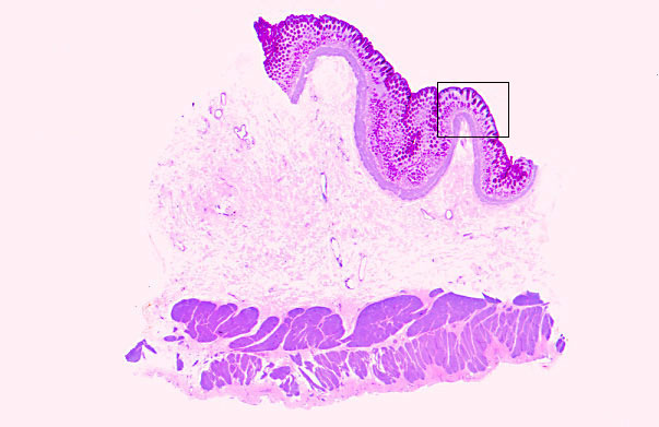  pyloric stomach 