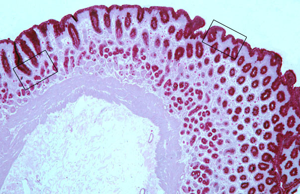  pyloric stomach, mucosa and submucosa 