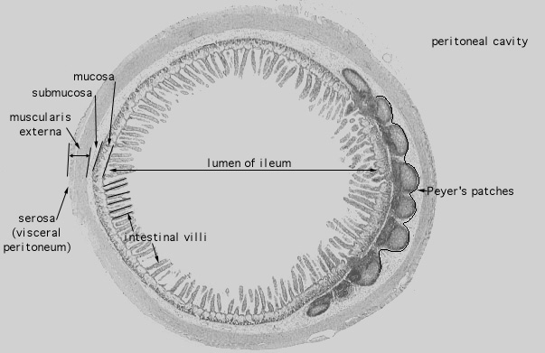 ileum 
