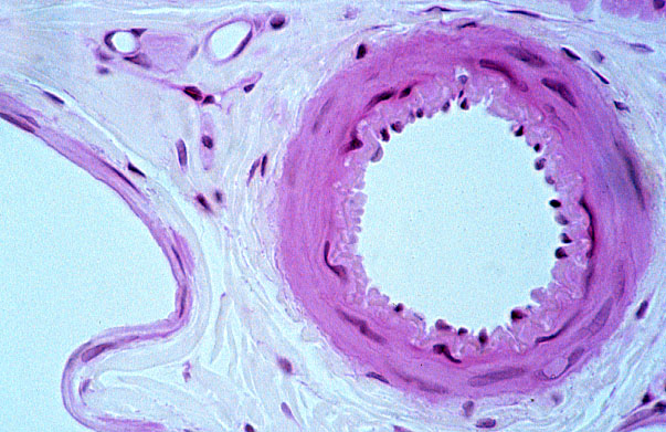  small muscular artery 