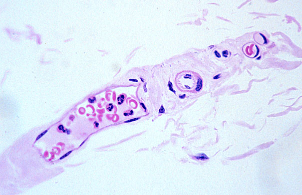  arteriole 