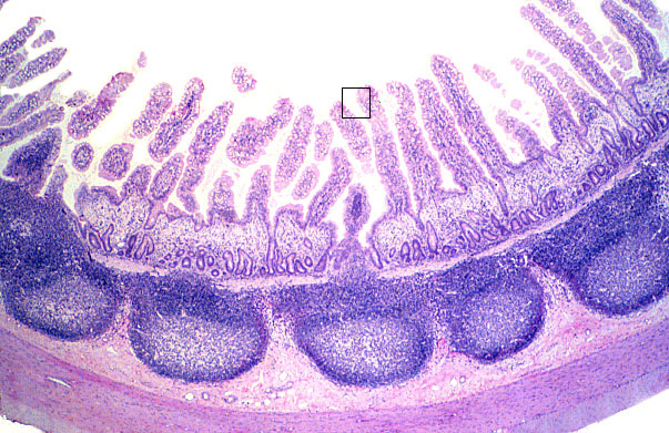  ileum, Peyer's patches 