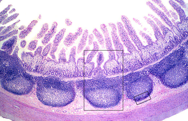  ileum, Peyer's patches 