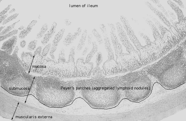  ileum, Peyer's patches 