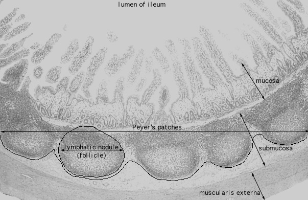  ileum, Peyer's patches 