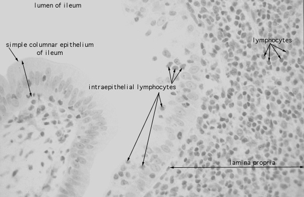  ileum, Peyer's patches 