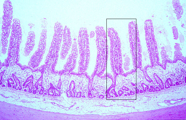  ileum, villi and crypts 