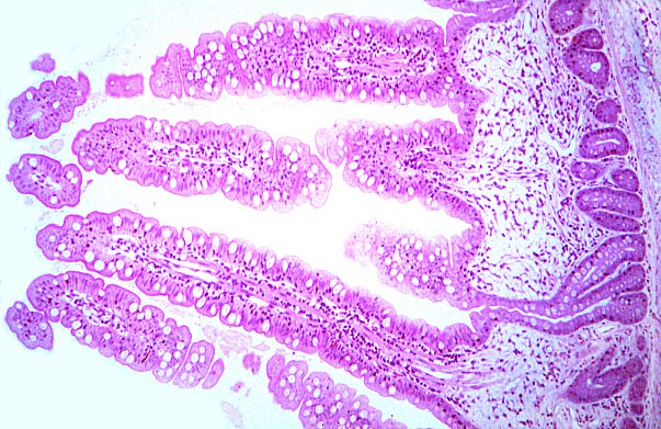  ileum, villi and crypts 
