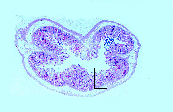  jejunum, enteroendocrine cells 
