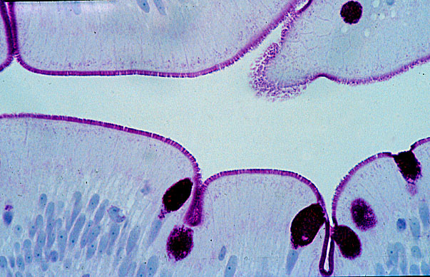  microvilli and glycocalyx 