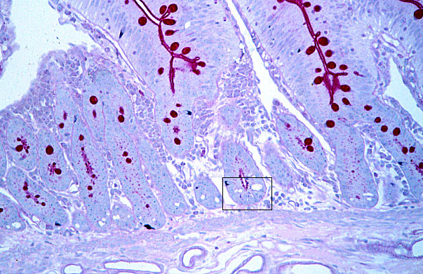  jejunum, enteroendocrine cells 