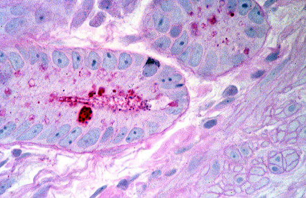  jejunum, enteroendocrine cells, APUD 