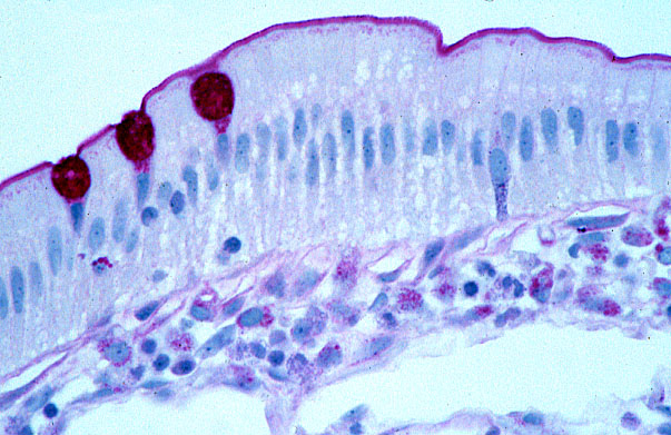  jejunum, glycocalyx and enteroendocrine cell 