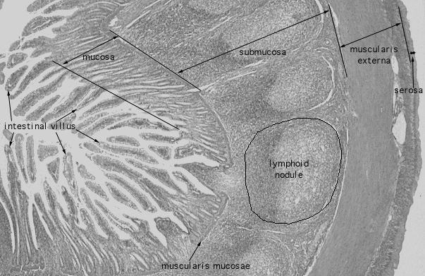  ileum II, Peyer's patches 
