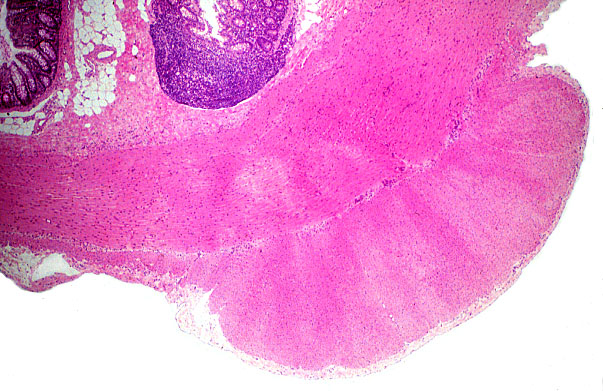  colon, taenia coli 