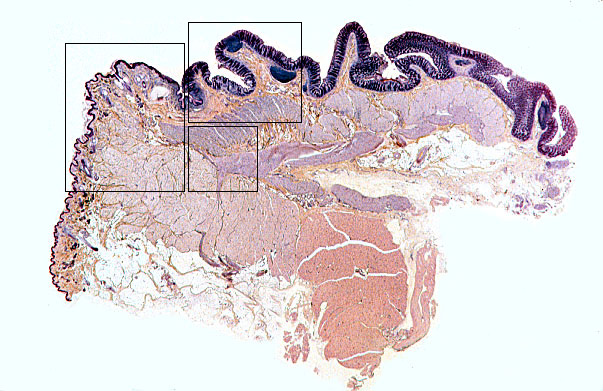  colon, anal canal 