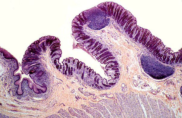  colon, anal canal, mucosa 