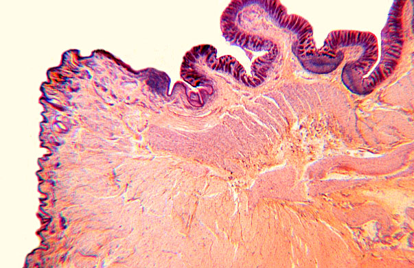  colon, anal canal, sphincters 