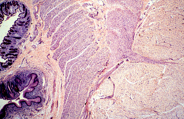  colon, anal canal, internal and external sphincters 