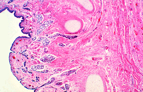  trachea, trachealis muscle 