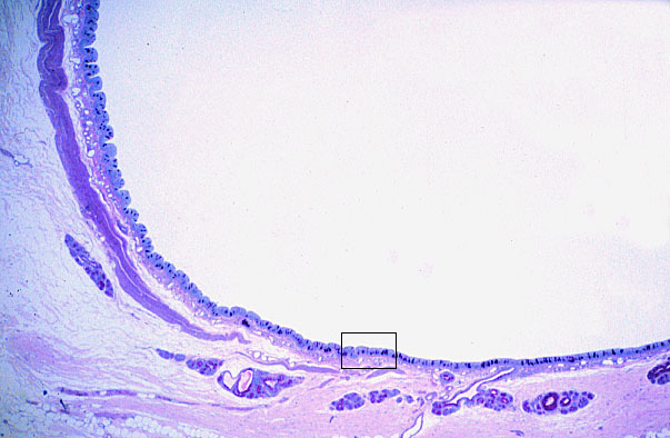  pseudostratified epithelium; cilia 