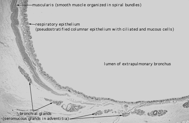  pseudostratified epithelium; cilia 