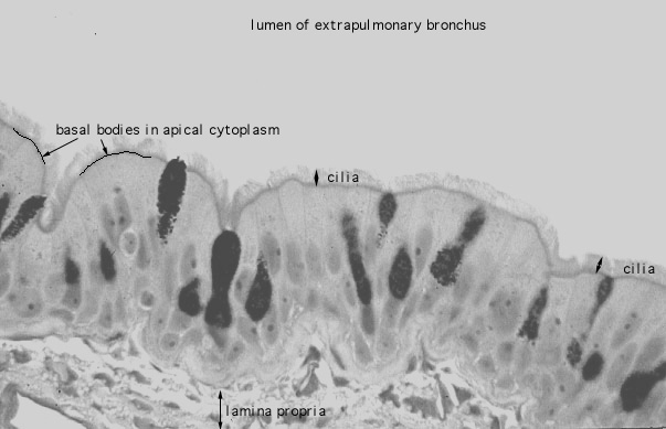  pseudostratified epithelium; cilia 