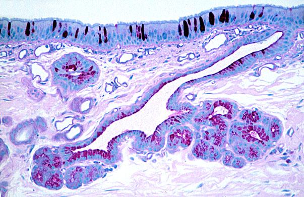  extrapulmonary bronchus, bronchial glands 
