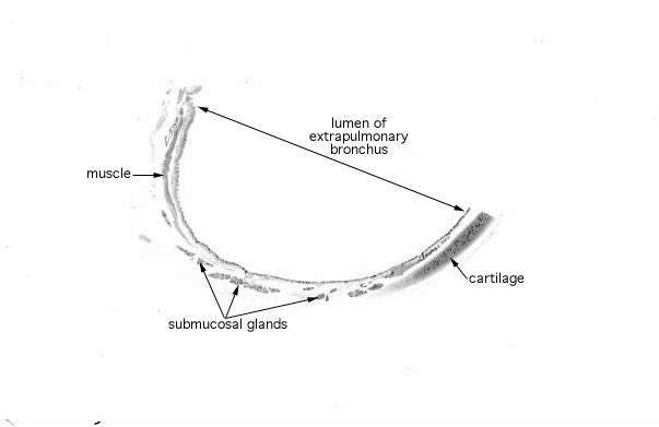  pseudostratified epithelium; cilia 