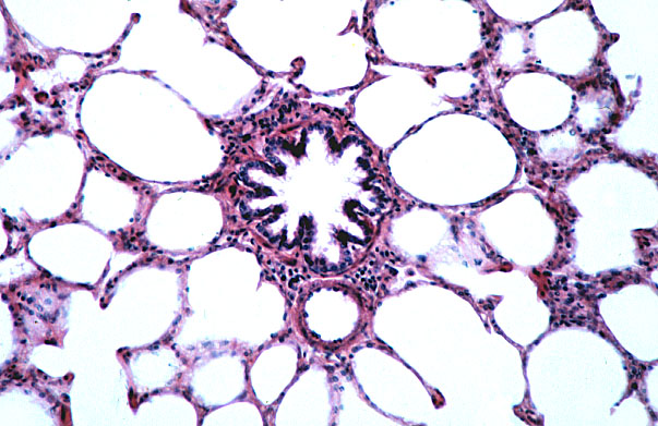  lung (sheep), bronchiole 