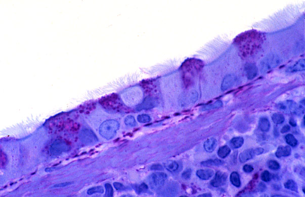  lung (mouse), respiratory epithelium 