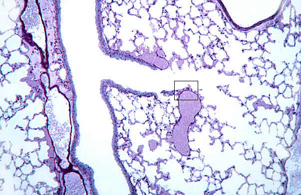  lung (mouse), bronchiole 